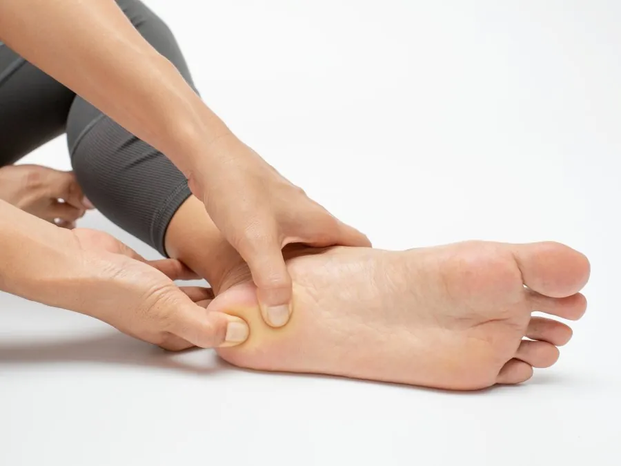 Illustration used for the plantar fasciitis embolization treatment page